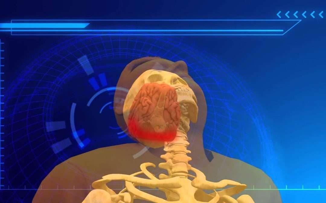 Whiplash injury may be cause of Mexican wrestler Pedro Aguayo Ramirez's death